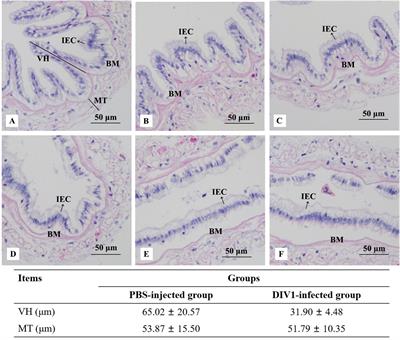 Integrated analysis of intestinal microbiota and metabolomic reveals that decapod iridescent virus 1 (DIV1) infection induces secondary bacterial infection and metabolic reprogramming in Marsupenaeus japonicus